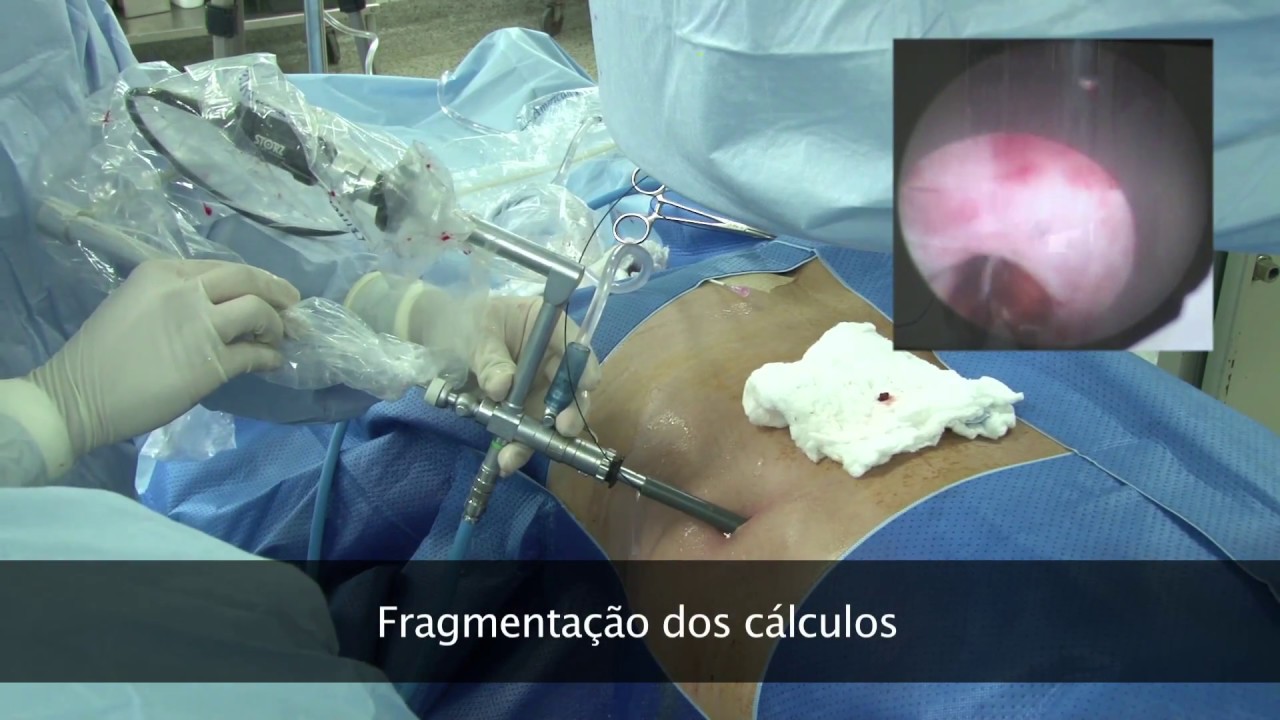 Guilherme Braga Lamacchia-27