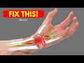 How To Fix Wrist Pain For Good