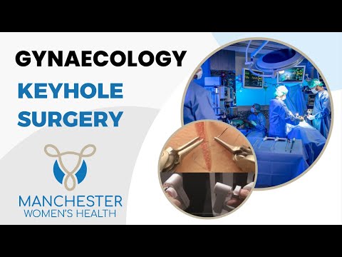 How BIG is the cut? Minimal Access Surgery in Gynaecology