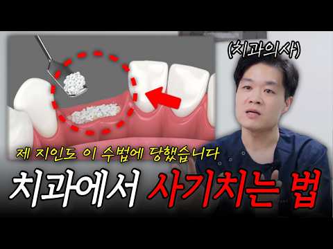 임플란트 뼈이식 사기치는법, 이런 치과는 제발 피해야 합니다❌