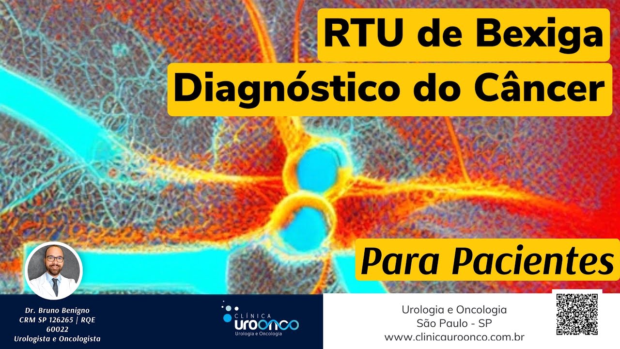 Cirurgia para o diagnóstico do Câncer de Bexiga - RTU - Urologista explica o Passo a Passo
