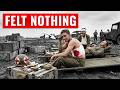 Why Germans Couldn’t Explain How Wounded Americans Felt No Pain DEFAULT Thumbnail