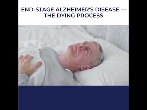 Uncovering the Reality of End-Stage Alzheimer's: How the Dying Process Unfolds 😶‍🌫