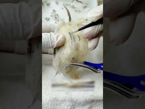 วิธีจัดการรังนกที่พึ่งเก็บมาสดๆ