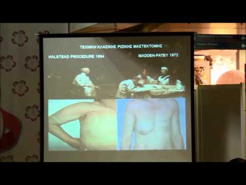 ΕΝΗΜΕΡΩΤΙΚΗ ΗΜΕΡΙΔΑ: ΚΑΡΚΙΝΟΣ ΜΑΣΤΟΥ "ΜΕΧΡΙ ΧΘΕΣ ΠΑΡΑΛΕΙΨΗ. ΑΠΟ ΣΗΜΕΡΑ ΠΡΟΛΗΨΗ"