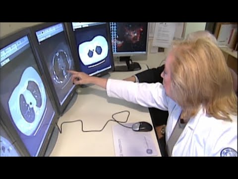 Cancer in ethnic groups