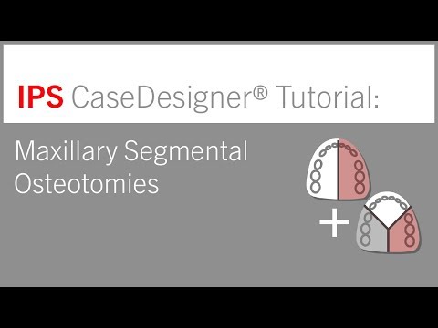 Maxillary Segmental Osteotomies | IPS CaseDesigner® Tutorial