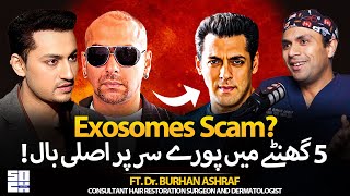 Exosomes Scam Exposed &amp; Salman Khan Hair Transplant Reality | PRP, FUE Hair Transplant | Dr. Burhan
