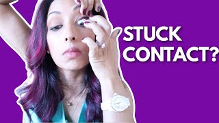 How to Get a Stuck Contact Lens Out | Eye Doctor Explains