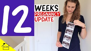 ULTRASOUND SCAN at 12 Weeks Experience (NHS UK) | Pregnancy Update
