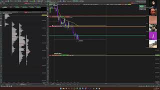 ENCERRANDO O DIA COM  +1.540 PTS MESMO DEPOIS DE UM STOP