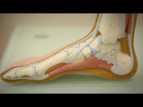 A bal könyökízület posztraumás artrózisa
