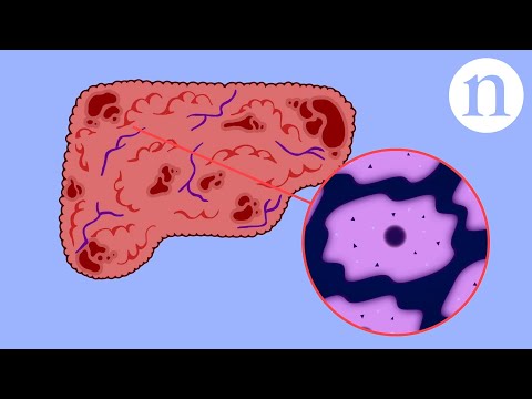 Scar wars: Repairing the liver