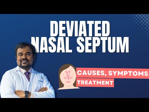 Deviated Nasal Septum | DNS Causes,Symptoms & Treatment #DNS