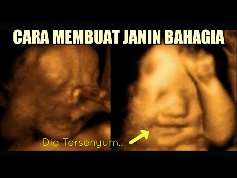 download video viral Cara Cepat Ibu Hamil, download Cara Cepat Ibu Hamil gratis, unduh video Cara Cepat Ibu Hamil