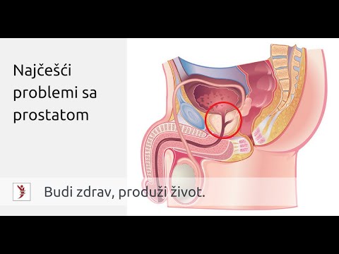 prostata ingrossata