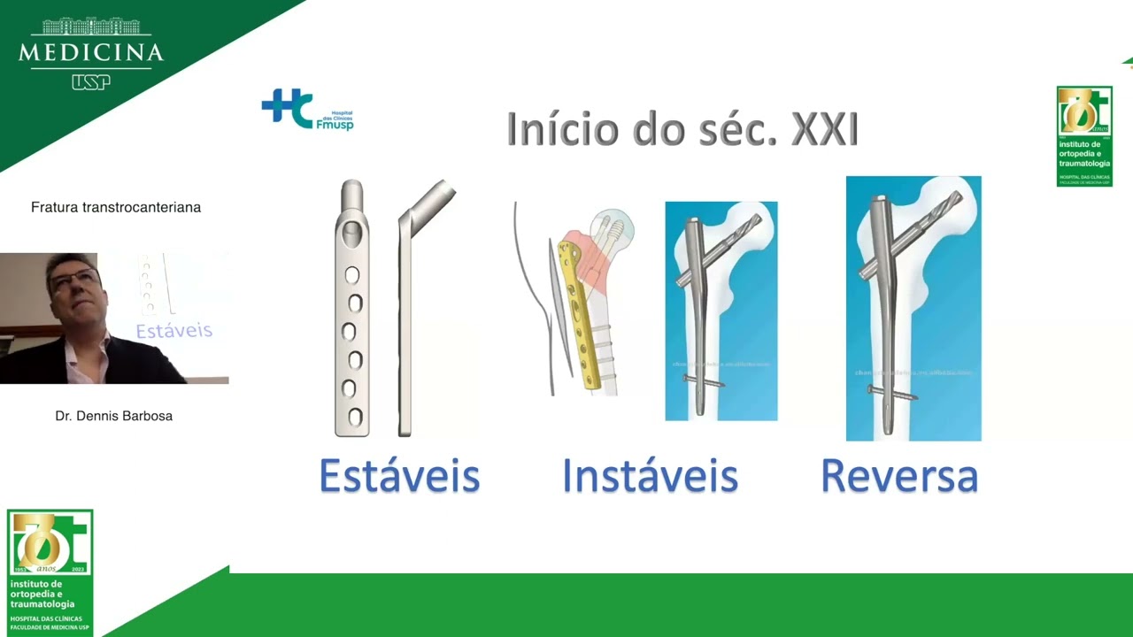 Fratura transtrocanteriana - Dr  Dennis Barbosa