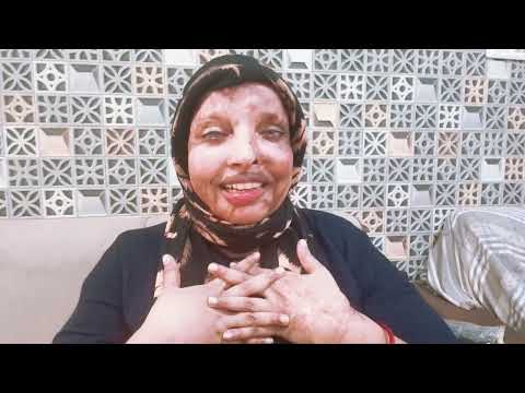 I have been selected as the brand ambassador for the international Purple Fest 2025 