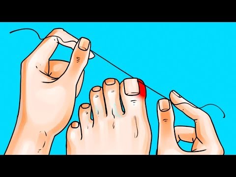 Wenn sie krank diabetischen unschuldig Blutzucker 8 Frauen