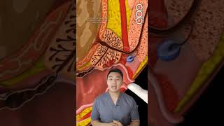 Download lagu Symptoms of prostate cancer in men! #prostate #prostatecancer #healthtips #healthvideos mp3