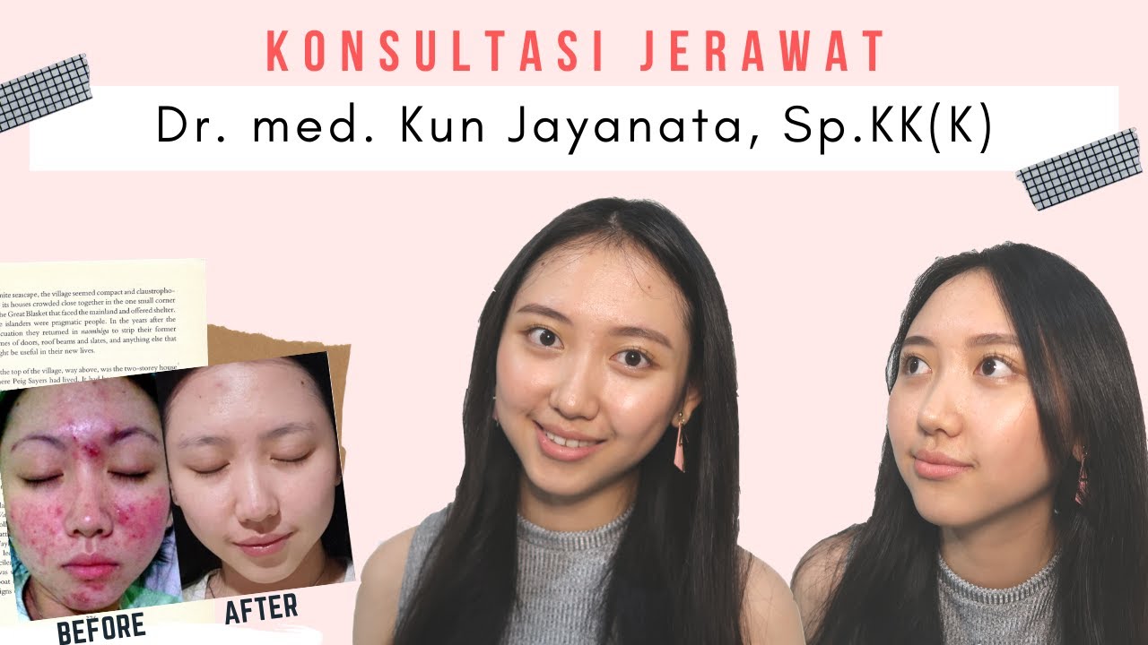 Acne Journey : Konsultasi JERAWAT Dokter Kun Jayanata
