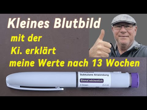 Kleines Blutbild durch die Ki  erklärt