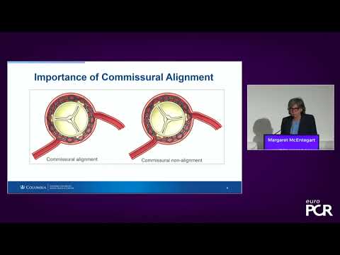 Double jeopardy: coronary disease in patients undergoing TAVI - EuroPCR 2022