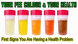 WHAT THE COLOUR OF YOU URINE SAYS ABOUT YOUR HEALTH. WEE, PEE COLOR SHOWS THE FIRST SIGNS OF PROBLEM