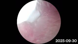 Relaxing Ear Cleaning ASMR | Deep Sleep, No Talking 2025-09-30 #asmr #deepsleep