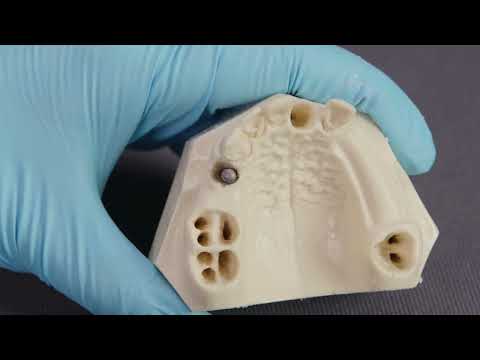 Straumann® iEXCEL™ drilling protocols: Straumann® BLC Implant System – Site 14