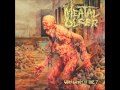 Meatal Ulcer - Why Won't It Die? [2013 Full Length Album]