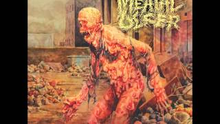 Meatal Ulcer - Why Won't It Die? [2013 Full Length Album]