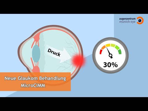Lasertherapie bei Glaukom (MicroCIMM) | MUNICH EYE