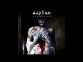 Acylum - Karzinom (Top 3 Tracks) 