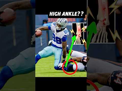 Doctor explains CeeDee Lamb’s SWOLLEN ankle injury #cowboys #dallascowboys #fantasyfootball #anatomy