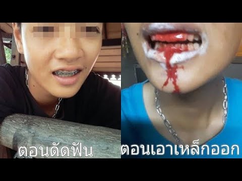 ผู้หญิงความแข็งแรงทางเพศ กระตุ้นยาเสพติดหลังจากหัวใจวาย