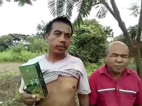 โรคสะเก็ดเงินรักษา celandine น้ำซุป ครีมโรคสะเก็ดเงิน palmoplantar