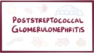 Poststreptococcal glomerulonephritis - causes, symptoms, treatment & pathology