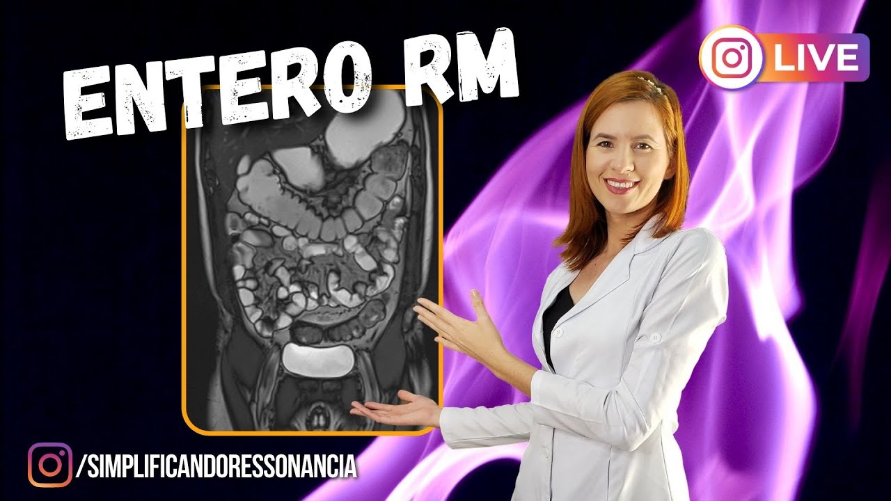 Live Instagram - Entero RM