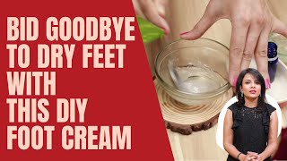 DIY Foot Cream | Aloe Vera Foot Cream For Dryness At Home | TimesXP Beauty