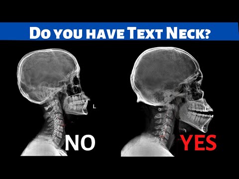 Is your Neck Pain or Back Pain due to Text Neck? *Find out!*