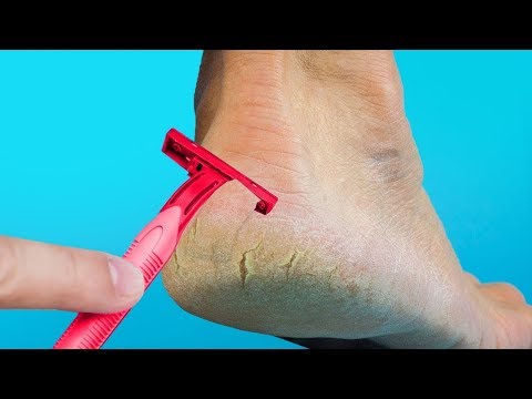 Tratamentul artrozei genunchiului cu ozokerită