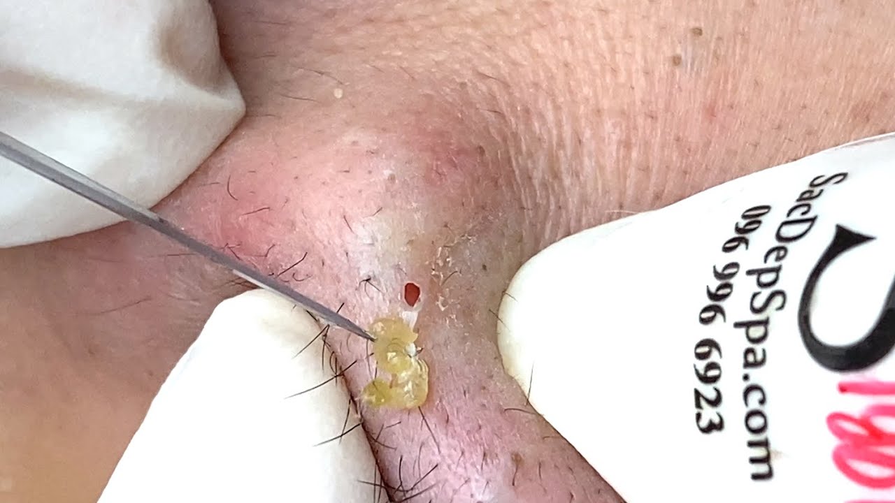 YouTube Thumbnail Downloader FULL HQ IMAGE