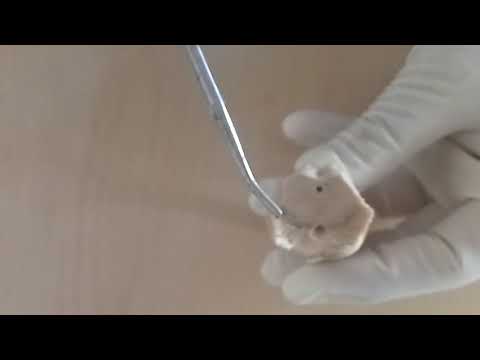 NEUROANATOMY - MIDBRAIN EXTERNAL FEATURES - BY DR MITESH DAVE