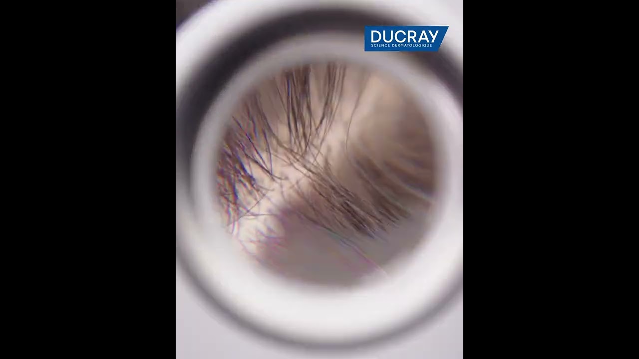 SHAMPOOING KELUAL DS INTENSIVE | Anti pellicules sévères, démangeaisons et sensations de brûlure.