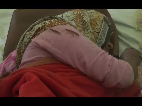 প্রেম না করায় সারা শরীর ব্লেড দিয়ে কর্তন