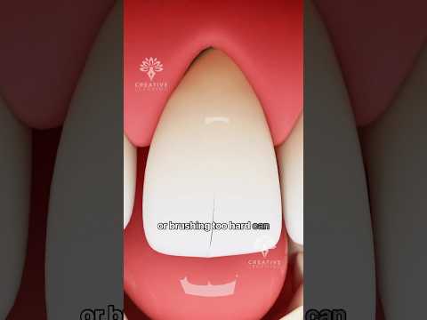 What Causes Teeth Sensitivity 🦷 #teethsensitivity  #shorts #viralvideo - Creativelearning3d