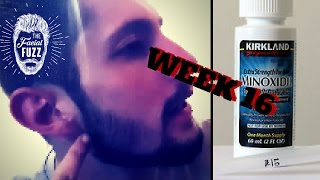 Minoxidil Beard | Week 16 | The Experiment |  #FacialFuzzFridays
