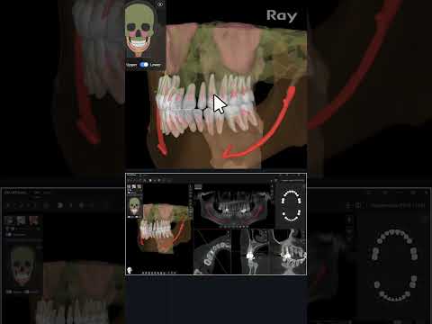 SMARTDent : 5D Tutorial #1-2. Slice Jump – Jump to Any Area Instantly
