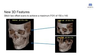 The Veraview FX800 is a CBCT X-ray unit that produces stunning images for medical evaluation. It is intended for the examination and diagnosis of the…